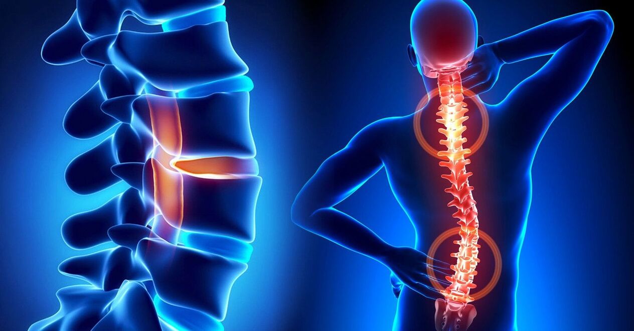 a sick spine leads to neck problems