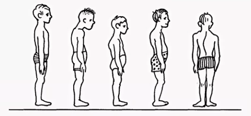 Violation of posture