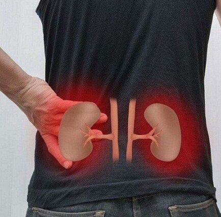 Low's pain can occur with pyelonephritis