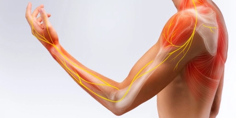 Pain and numbness of the fingers indicate damage to the ligaments due to stenosing ligamentitis