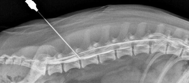 blockade of the spine with osteochondrosis